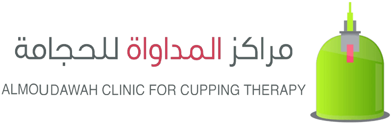 المداواة-للحجامة