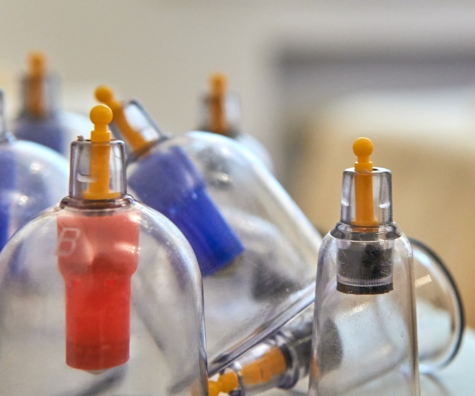 images for website_dry cupping